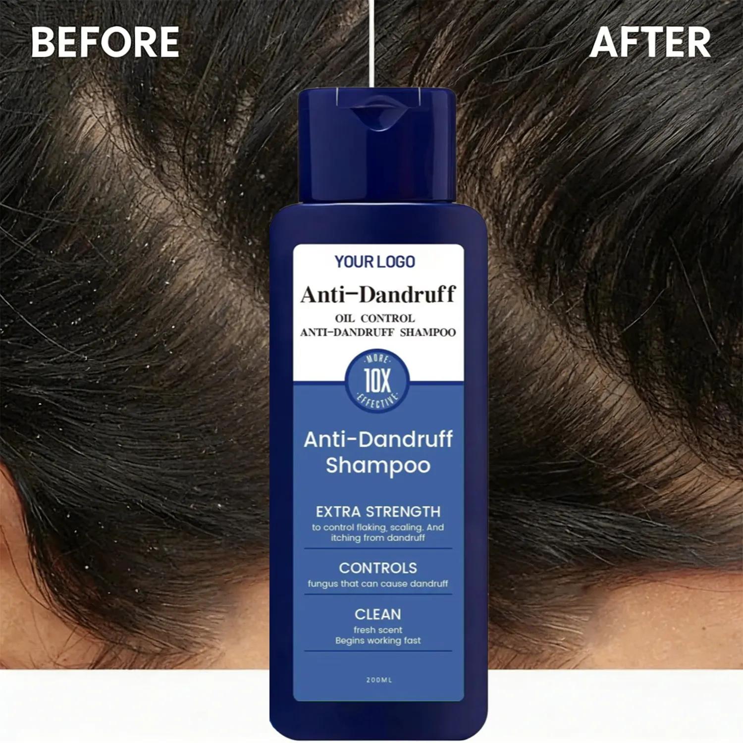 Anti-Dandruff Shampoo - Image 2